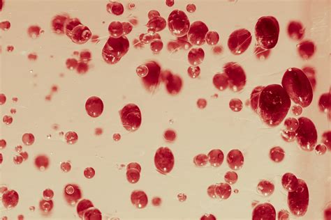 uriplasma|ureaplasma betekenis.